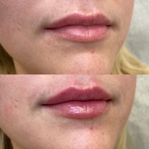 1890EE10-0AF8-4BAB-8543-7ABA3A5A1E12