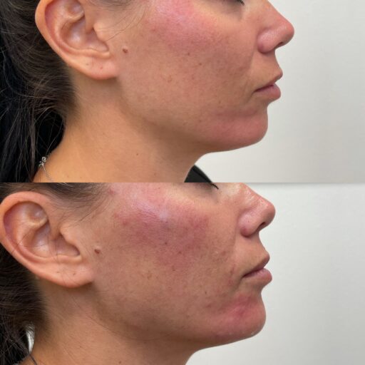 194F726A-032A-4EA7-AF2E-FC47452A4933