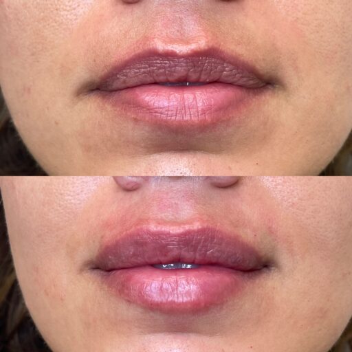 4DE99094-65D0-4486-8ADC-65FBF08970AE