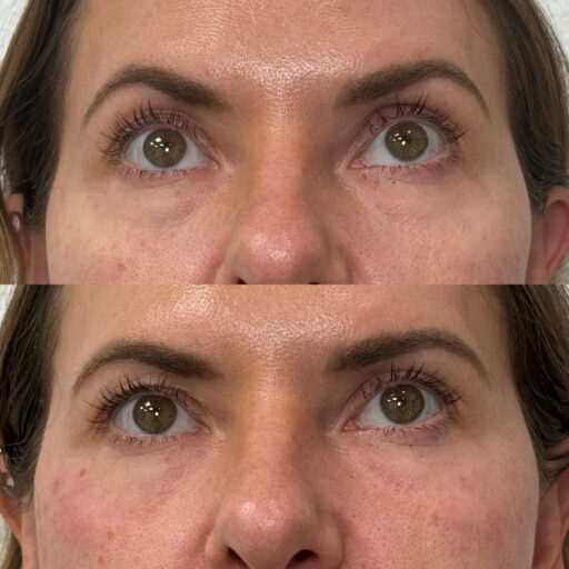 5AA4ED8B-47DC-48C6-8716-60A354C5FE18