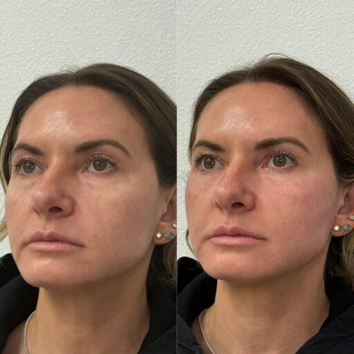 6CB47AB4-ADD6-47A9-81AF-76A7990F2452