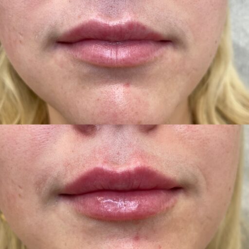 7E87A28C-FA81-422A-A0CB-D944BF07BF32