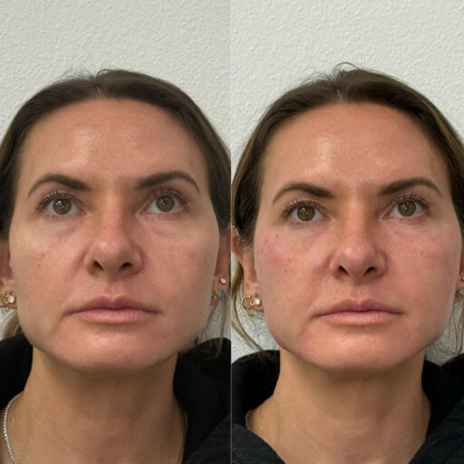 EF842A44-FD12-457E-91D7-E879F3C9D314